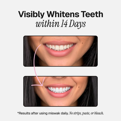 Miswak | Ancient Natural Toothbrush