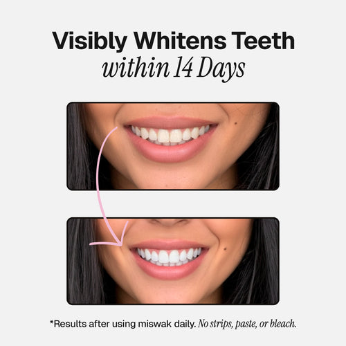 Miswak | Ancient Natural Toothbrush